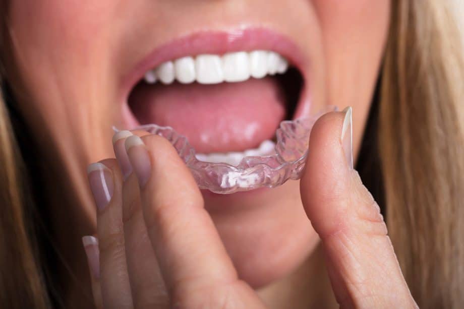 Pros and Cons of Using Invisalign