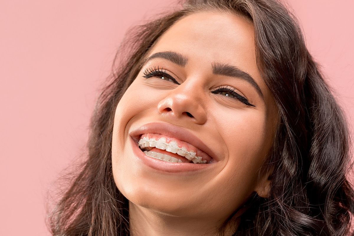 How Much Are Clear Braces in Las Cruces, NM? Las Cruces Smiles