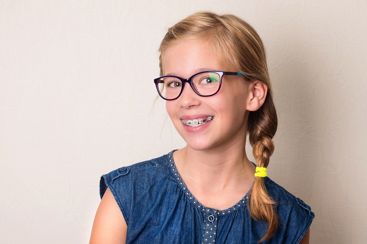 How Old Do You Have To Be To Get Braces?