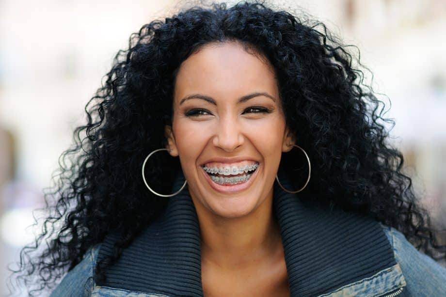 What to Expect During Your First Week With Metal Braces
